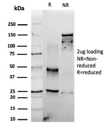 SDS-PAGE Analysis of Purified Fascin-1 Recombinant Mouse Monoclonal Antibody (rFSCN1/6464). Confirmation of Integrity and Purity of Antibody. Recombinant Fascin-1 (Reed-Sternberg CellMarker) Antibody
