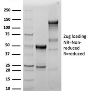 SDS-PAGE Analysis of Purified Fascin-1 Recombinant Mouse Monoclonal Antibody (FSCN1/6465R). Confirmation of Integrity and Purity of Antibody.