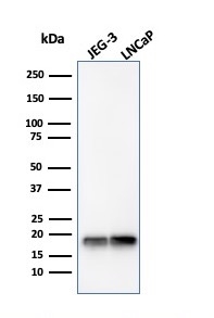 Western Blot Analysis of JEG-3 and LNCaP cell lysates using Superoxide Dismutase 1 Mouse Monoclonal Antibody (SOD1/4330).
