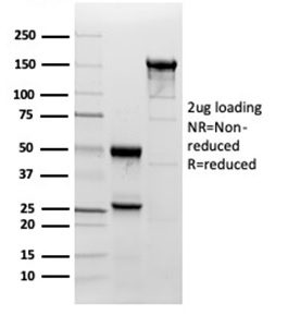 SDS-PAGE Analysis Purified Superoxide Dismutase 1 Mouse Monoclonal Antibody (SOD1/3923). Confirmation of Integrity and Purity of Antibody.