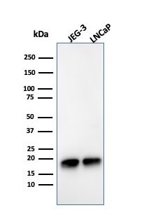 Western Blot Analysis of JEG-3 and LNCaP cell lysates using Superoxide Dismutase 1 Mouse Monoclonal Antibody (SOD1/3925).