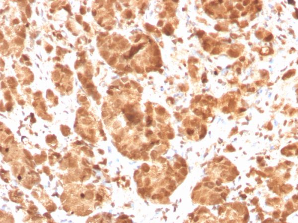 Formalin-fixed, paraffin-embedded human tonsil stained with Superoxide Dismutase 1 Mouse Monoclonal Antibody (SOD1/3926).