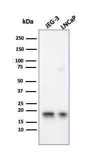 Western Blot Analysis of JEG-3 and LNCaP cell lysates using Superoxide Dismutase 1 Mouse Monoclonal Antibody (SOD1/3926).