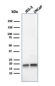 Western Blot Analysis of JEG-3 and LNCaP cell lysates using Superoxide Dismutase 1 Mouse Monoclonal Antibody (SOD1/4248).
