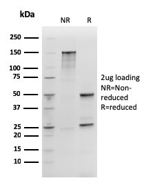 SDS-PAGE Analysis SOX2 Recombinant Mouse Monoclonal Antibody (rSOX2/1792). Confirmation of Purity and Integrity of Antibody.