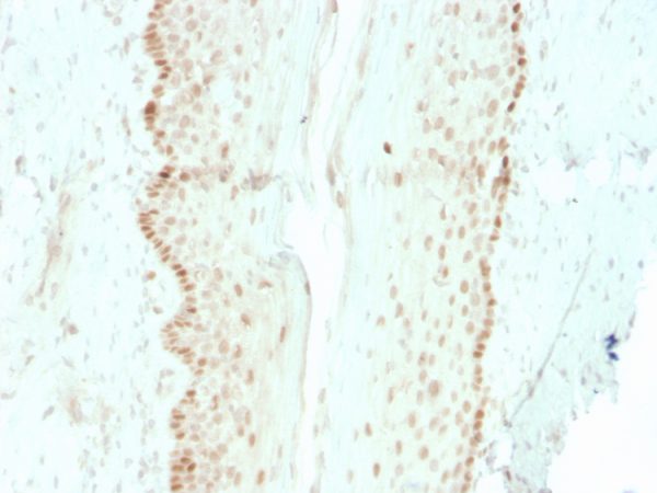 Formalin-fixed, paraffin-embedded human cervix stained with SOX2 Recombinant Mouse Monoclonal Antibody (rSOX2/1792).