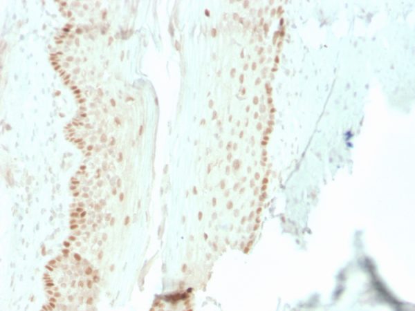 Formalin-fixed, paraffin-embedded human cervix stained with SOX2 Recombinant Mouse Monoclonal Antibody (rSOX2/1792).