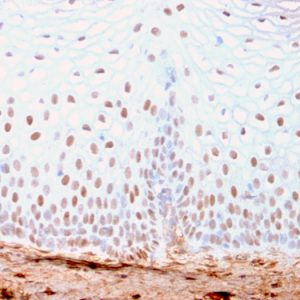 Formalin-fixed, paraffin-embedded human Skin stained with SOX2 Recombinant Rabbit Monoclonal Antibody (SOX2/3169R).