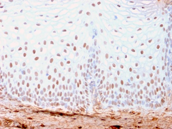 Formalin-fixed, paraffin-embedded human Skin stained with SOX2 Recombinant Rabbit Monoclonal Antibody (SOX2/3169R).
