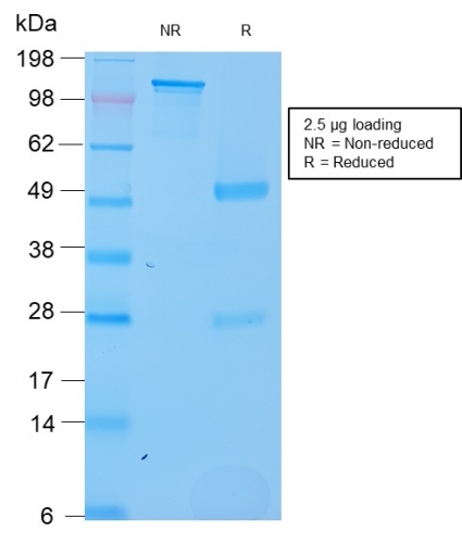 SDS-PAGE Analysis Purified SOX2 Recombinant Rabbit Monoclonal Antibody (SOX2/3169R). Confirmation of Purity and Integrity of Antibody.