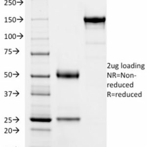 SDS-PAGE Analysis Purified SOX9 Mouse Monoclonal Antibody (PCRP-SOX9-1E5). Confirmation of Purity and Integrity.