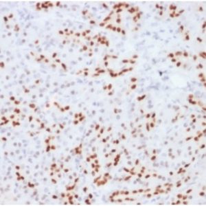Formalin-fixed, paraffin-embedded human pancreas stained with SOX9 Mouse Monoclonal Antibody (SOX9/2104)