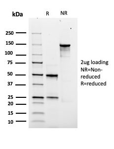 SDS-PAGE Analysis of Purified SOX9 Recombinant Mouse Monoclonal Antibody (rSOX9/2288). Confirmation of Purity and Integrity of Antibody.