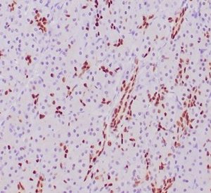 Formalin-fixed, paraffin-embedded human pancreas stained with SOX9 Mouse Monoclonal Antibody (SOX9/2387) at 2ug/ml. HIER: Tris/EDTA, pH9.0, 45min. 2 °: HRP-polymer, 30min. DAB, 5min.
