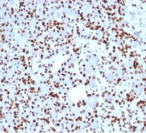 Formalin-fixed, paraffin-embedded human pancreas stained with SOX9 Mouse Monoclonal Antibody (SOX9/2398). HIER: Tris/EDTA, pH9.0, 45min. 2°C: HRP-polymer, 30min. DAB, 5min.