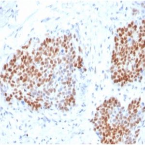 Formalin-fixed, paraffin-embedded human pancreas stained with SOX9 Recombinant Rabbit Monoclonal Antibody (SOX9/3916R). HIER: Tris/EDTA, pH9.0, 45min. 2°C: HRP-polymer, 30min. DAB, 5min.