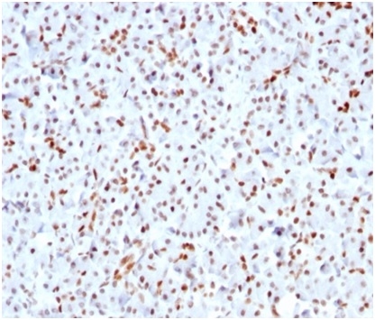 Formalin-fixed, paraffin-embedded human pancreas stained with SOX9 Recombinant Rabbit Monoclonal Antibody SOX9/3141R). HIER: Tris/EDTA, pH9.0, 45min. 2 °: HRP-polymer, 30min. DAB, 5min.