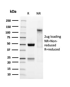 SDS-PAGE Analysis Purified SOX9 Recombinant Rabbit Monoclonal Antibody (SOX9/3141R). Confirmation of Purity and Integrity of Antibody.