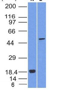 Western Blot Analysis of SOX10 (A) Recombinant protein (B) A375 cell lysate using SOX10 Mouse Monoclonal Antibody (SOX10/992).