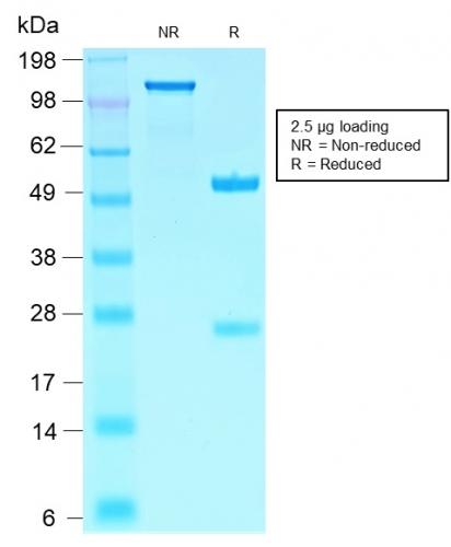 SDS-PAGE Analysis Purified SOX10-Monospecific Recombinant Rabbit Monoclonal Antibody (SOX10/2311R). Confirmation of Integrity and Purity of Antibody.