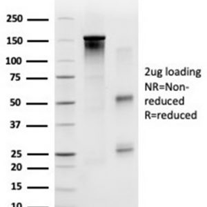 SDS-PAGE Analysis Purified SP100 Mouse Monoclonal Antibody (PCRP-SP100-1B9). Confirmation of Purity and Integrity of Antibody.