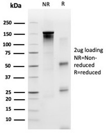 SDS-PAGE Analysis Purified SP100 Mouse Monoclonal Antibody (PCRP-SP100-1B9). Confirmation of Purity and Integrity of Antibody. SP100 Antibody