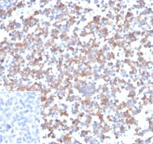 Formalin-fixed, paraffin-embedded human tonsil stained with SPARC / Osteonectin Mouse Monoclonal Antibody (OSTN/3933). Inset: PBS instead of primary antibody; secondary only negative control.