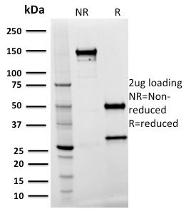 SDS-PAGE Analysis of Purified SPASTIN Mouse Monoclonal Antibody (Sp 3G11-1). Confirmation of Purity and Integrity of Antibody.