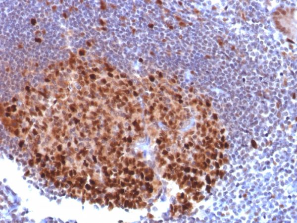 Formalin-fixed, paraffin-embedded human Lymph Node stained with PU.1 Mouse Monoclonal Antibody (PU1/2118).