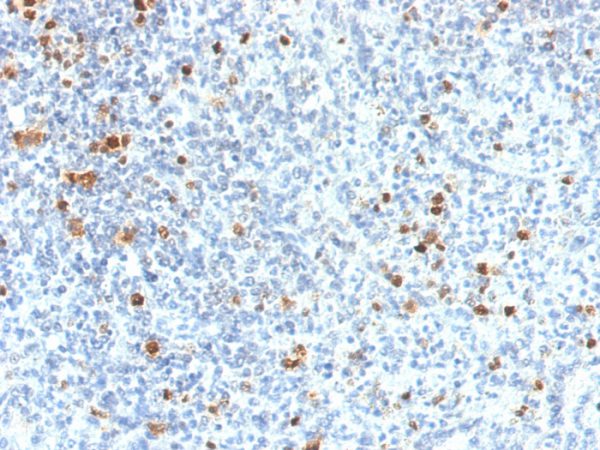 Formalin-fixed, paraffin-embedded human Spleen stained with PU.1 Mouse Monoclonal Antibody (PU1/2118).