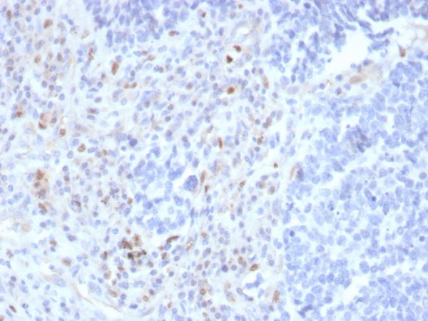 Formalin-fixed, paraffin-embedded human lymph node stained with PU.1 Recombinant Mouse Monoclonal Antibody (rPU1/2146).