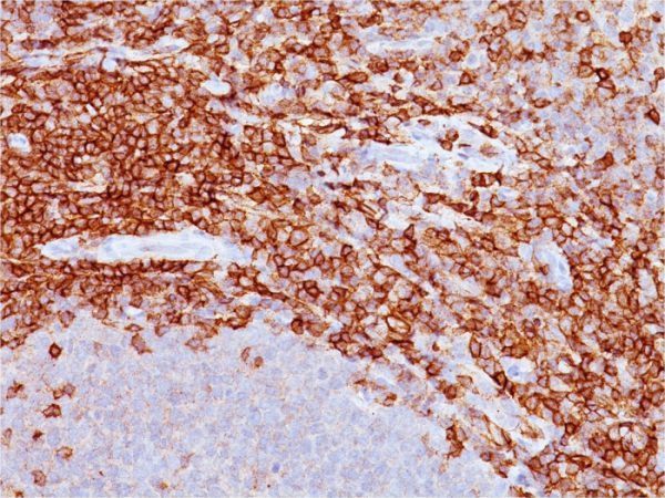 Formalin-fixed, paraffin-embeddedhuman spleen stained with CD43 Mouse Monoclonal Antibody (DF-T1).