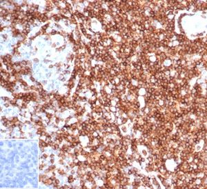 Formalin-fixed, paraffin-embedded human tonsil stained with CD43 Recombinant Mouse Monoclonal Antibody (rSPN/6563) at 2ug/ml. Inset: PBS instead of primary antibody, secondary negative control.