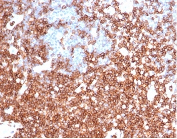 IHC analysis of formalin-fixed, paraffin-embedded human colon. Strong membrane staining using rSPN/6563 at 2ug/ml in PBS for 30min RT. HIER: Tris/EDTA, pH9.0, 45min. 2°C: HRP-polymer, 30min. DAB, 5min.