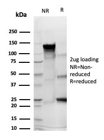 SDS-PAGE Analysis of Purified CD43 Recombinant Mouse Monoclonal Antibody (rSPN/6563). Confirmation of Integrity and Purity of Antibody.
