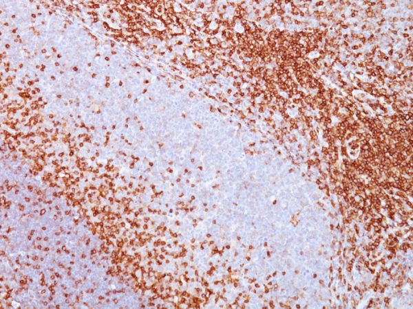 Formalin-fixed, paraffin-embedded human spleen stained with CD43 Mouse Monoclonal Antibody (SPN/839).