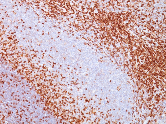 Formalin-fixed, paraffin-embedded human spleen stained with CD43 Mouse Monoclonal Antibody (SPN/839). CD43 (T-Cell Marker) Antibody