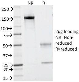 SDS-PAGE Analysis Purified CD43 Mouse Monoclonal Antibody (SPN/839). Confirmation of Integrity and Purity of Antibody.