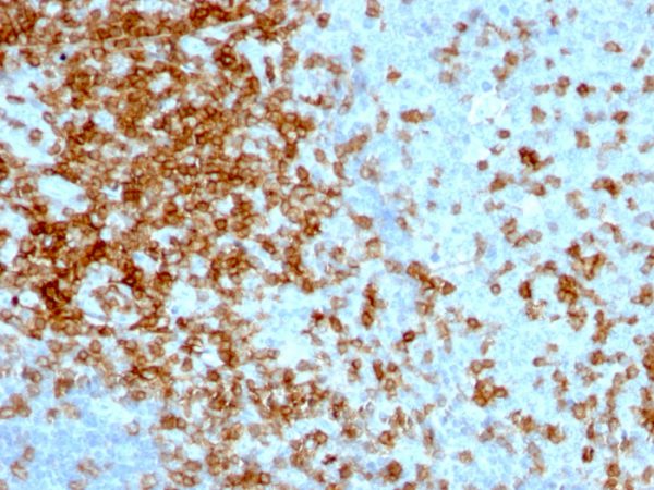 Formalin-fixed, paraffin-embedded human Tonsil stained with CD43 Mouse Monoclonal Antibody (84-3C1).