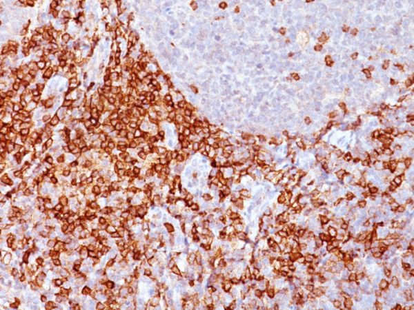 Formalin-fixed, paraffin-embedded human Spleen stained with CD43 Mouse Monoclonal Antibody (Bra7G).