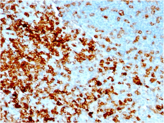 Formalin-fixed, paraffin-embedded human Tonsil stained with CD43 Mouse Recombinant Monoclonal Antibody (rSPN/1094). Recombinant CD43 (T-Cell Marker) Antibody - Image 2