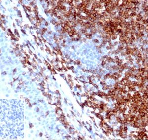Formalin-fixed, paraffin-embedded human tonsil stained with CD43 Recombinant Rabbit Monoclonal Antibody (SPN/6562R). Inset: PBS instead of primary antibody, secondary negative control.