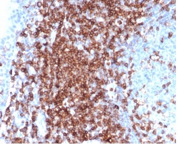 IHC analysis of formalin-fixed, paraffin-embedded human tonsil. Strong membranous staining using SPN/6562R at 2ug/ml in PBS for 30min RT. HIER: Tris/EDTA, pH9.0, 45min. 2°C: HRP-polymer, 30min. DAB, 5min.