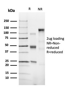 SDS-PAGE Analysis of Purified CD43 Recombinant Rabbit Monoclonal Antibody (SPN/6562R). Confirmation of Integrity and Purity of Antibody.