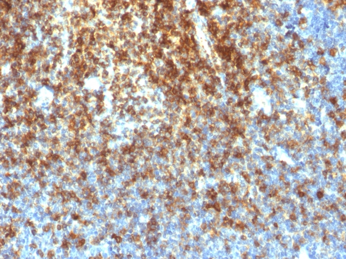 Formalin-fixed, paraffin-embedded human Tonsil stained with CD43 Rabbit Recombinant Monoclonal Antibody (SPN/1766R). Recombinant CD43 (T-Cell Marker) Antibody