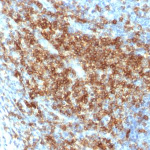 Formalin-fixed, paraffin-embedded human Tonsil stained with CD43 Rabbit Recombinant Monoclonal Antibody (SPN/2049R).