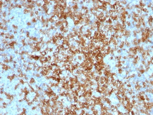 Formalin-fixed, paraffin-embedded human Tonsil stained with CD43 Rabbit Polyclonal Antibody.