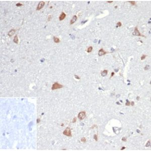 Formalin-fixed, paraffin-embedded human brain stained with Osteopontin Rat Monoclonal Antibody (OSP/4589). Inset: PBS instead of primary antibody; secondary only negative control.