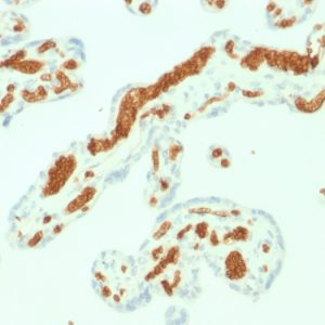 Formalin-fixed, paraffin-embedded human Placenta stained with Spectrin alpha 1 (SPTA1) Mouse Monoclonal Antibody (SPTA1/1832).