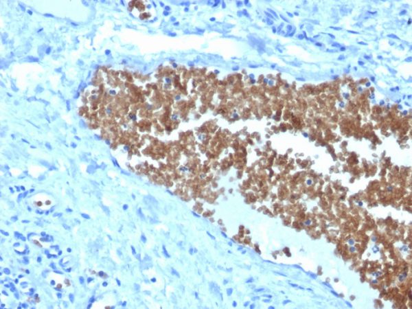 Formalin-fixed, paraffin-embedded human Tonsil stained with Spectrin alpha 1 (SPTA1) Mouse Monoclonal Antibody (SPTA1/1832).